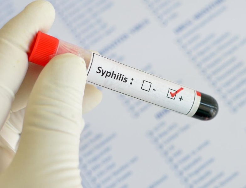  анализ на сифилис 